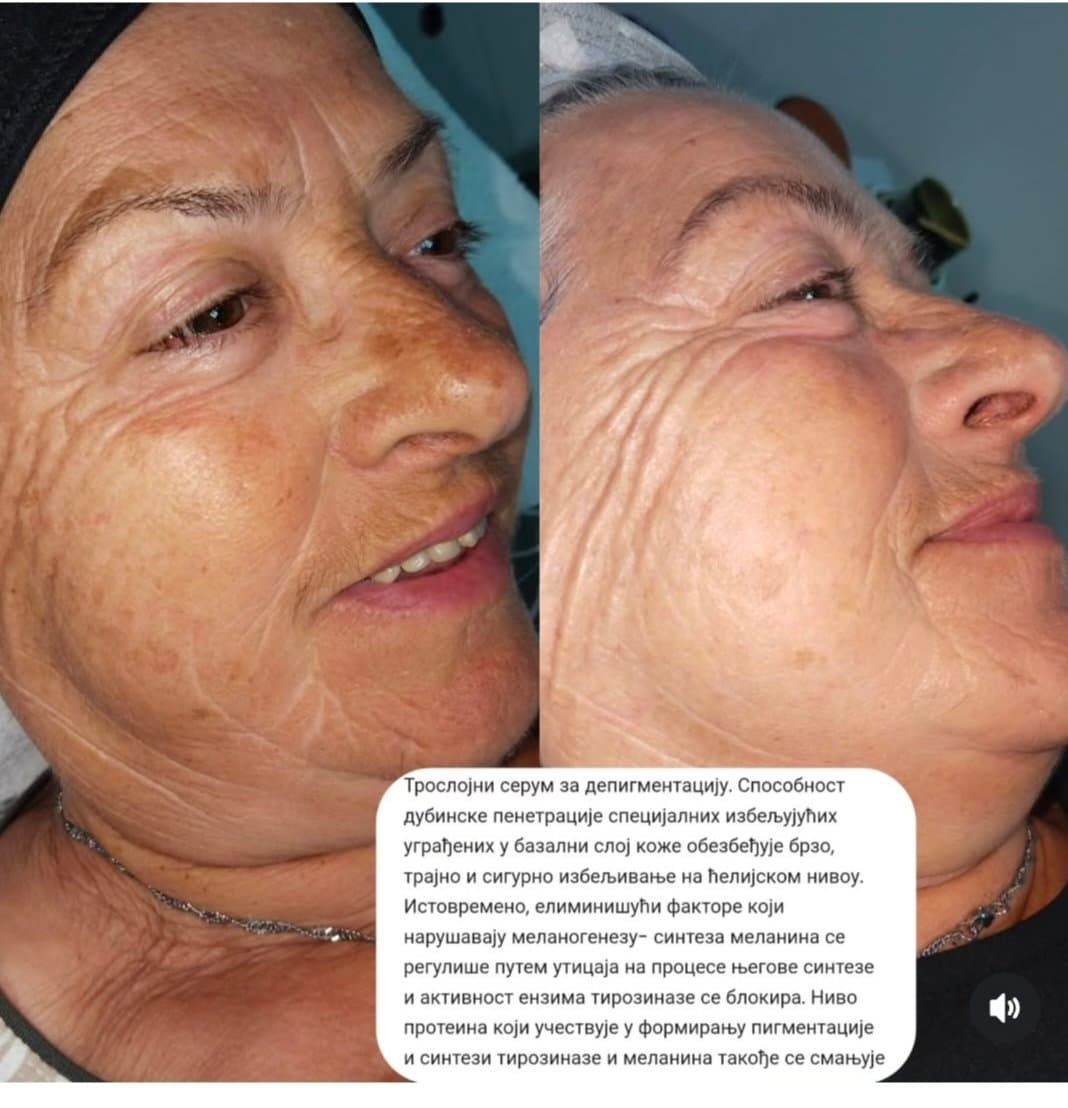 Mona Beauty fotografija 3